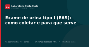 Exame de urina tipo I (EAS): como coletar e para que serve